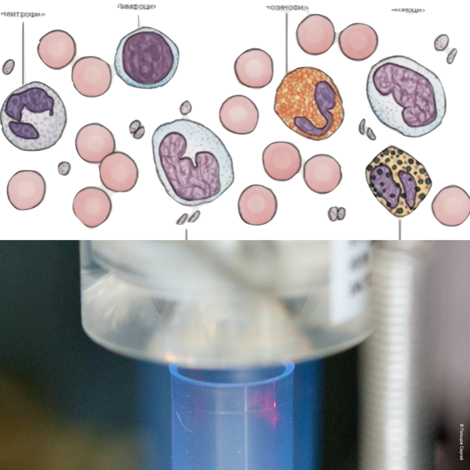 METHOD FOR DETERMINING SUBPOPULATION COMPOSITION OF SKIN CELLS AND OBTAINING SKIN CYTOIMMUNOGRAM